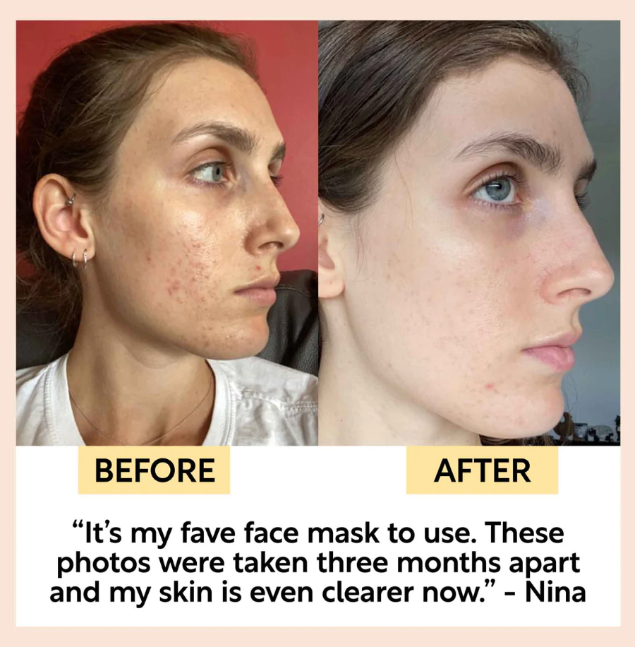 Upcircle - Mask Facial Kaolin Clay (2.FO)