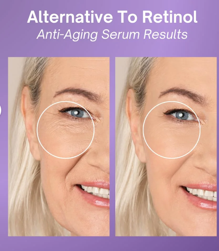Excuse My Frank - Serum Age Defense (2.7FO)