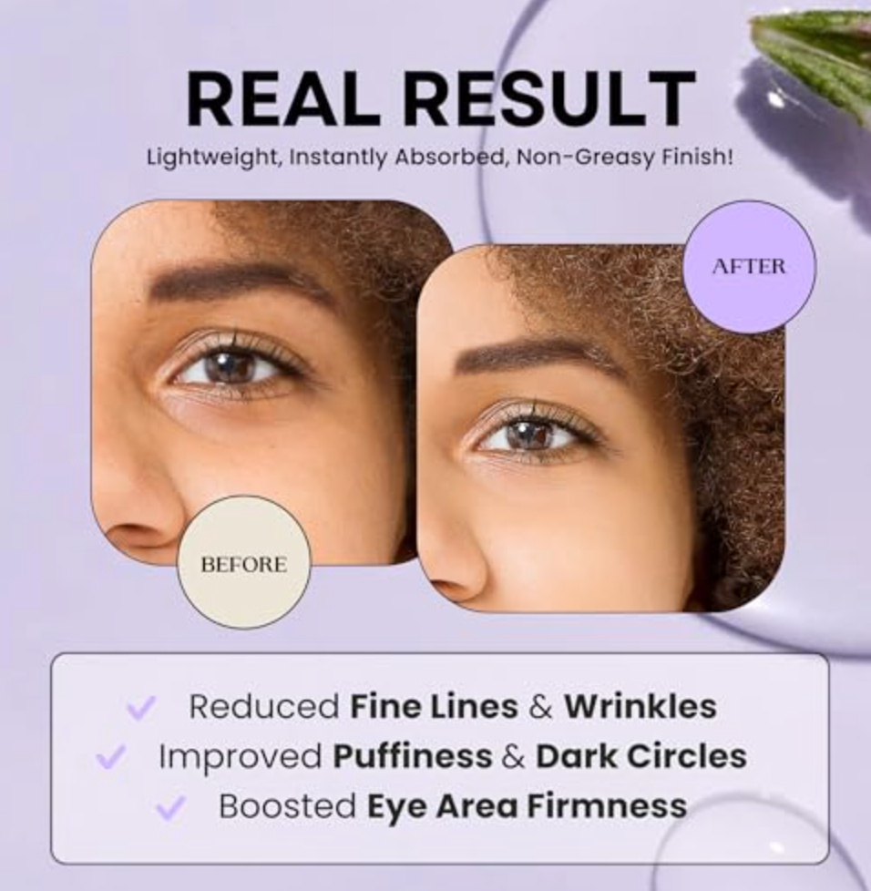 Excuse My Frank - Cream Eye Age Defense (1.1FO)