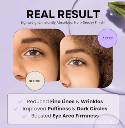 Excuse My Frank - Cream Eye Age Defense (1.1FO)